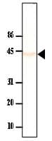 IHC-plus™ PP2Ac / PPP2CA Antibody (clone P6C7)