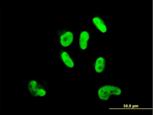 IHC-plus™ SOX9 Antibody (clone 3C10)