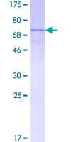 Human LIPA / Lysosomal Acid Lipase Protein (Recombinant GST)