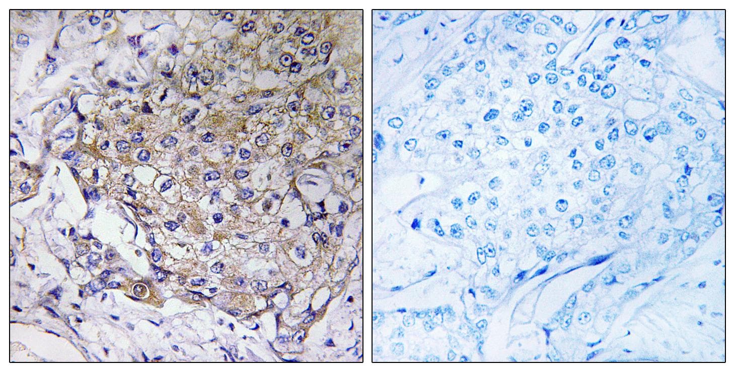 WASF3 Antibody