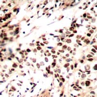 RAD51 / RECA Antibody (C-Terminus)