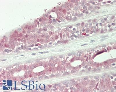 IHC-plus™ UBA1 / UBE1 Antibody (aa1008-1058)
