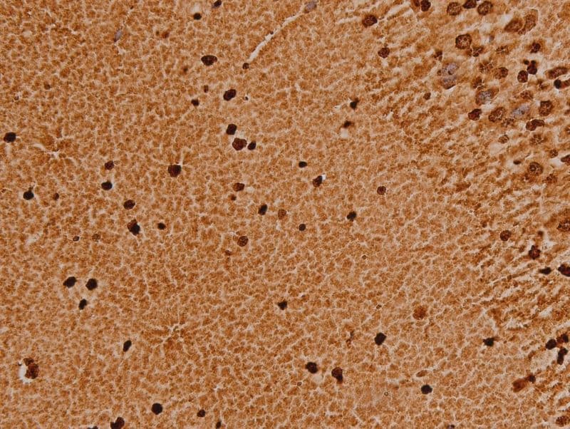 TRIM21 / RO52 Antibody