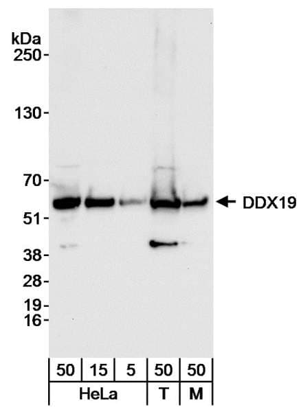 Polyclonal Rabbit anti-Human DDX19B Antibody (aa450-C-term, IHC, WB)