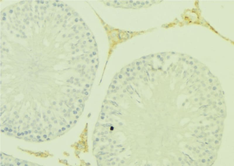 KLK5 / Kallikrein 5 Antibody