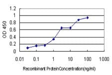 IHC-plus™ Monoclonal Mouse anti-Human USP33 / VDU1 Antibody (clone 5B5, IHC, IF, WB)