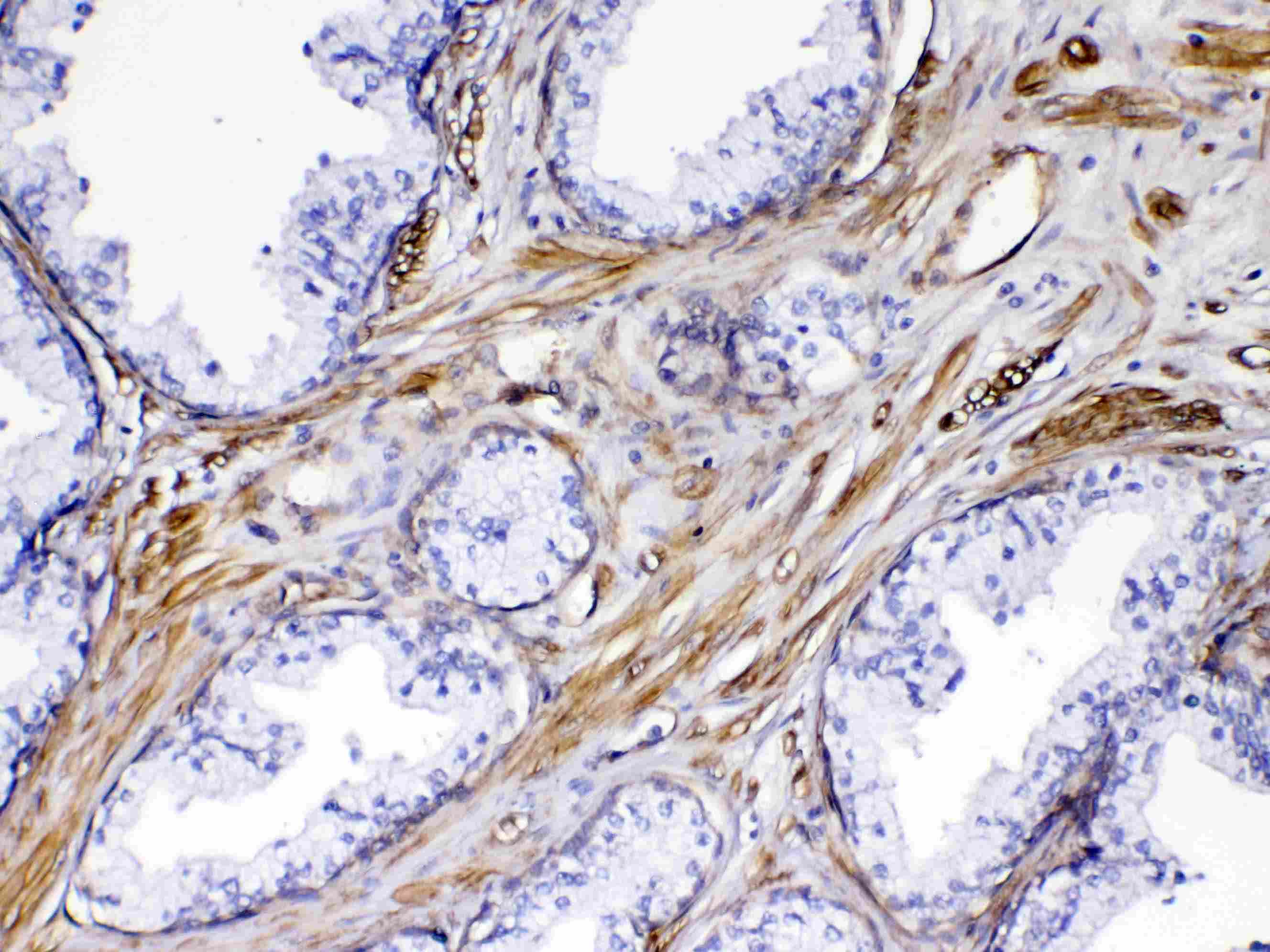FLT4 / VEGFR3 Antibody