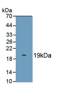 S100A8 / MRP8 Antibody (aa1-89)