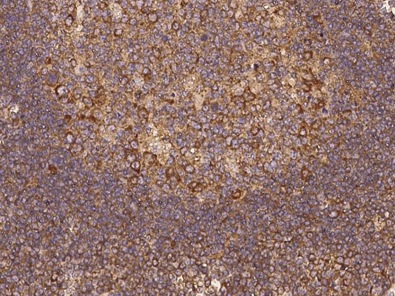 SNX21 Antibody