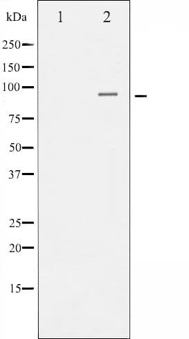 Polyclonal Rabbit anti-Human CTNNB1 / Beta Catenin Antibody (IHC, IF, WB)