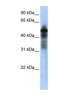 RORC / ROR Gamma Antibody (aa179-228)