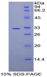 Human AMY2A / Pancreatic Amylase Protein (Recombinant His-T7)