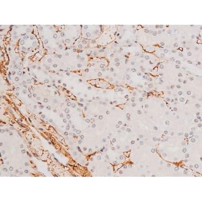 MAPK8 / JNK1 Antibody (phospho-Thr183,pTyr185)