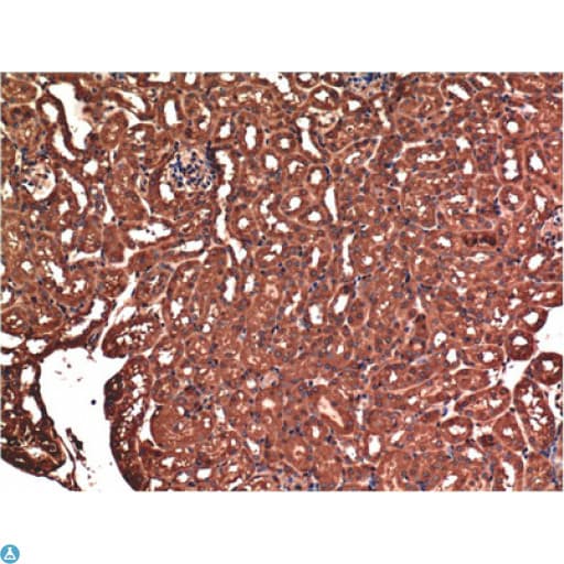 Monoclonal Mouse anti-Human BAX Antibody (IHC, WB)