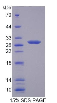 Human CRISP2 / TSP1 Protein (Recombinant His-T7)