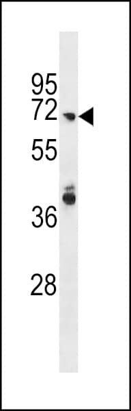 Polyclonal Rabbit anti-Human ARHGAP40 Antibody (aa91-117, WB)
