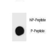 Tuberin / TSC2 Antibody (phospho-Ser1419)