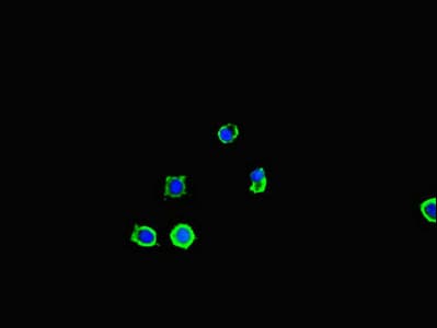 Polyclonal Rabbit anti-Human SQSTM1 Antibody (IHC, IF)