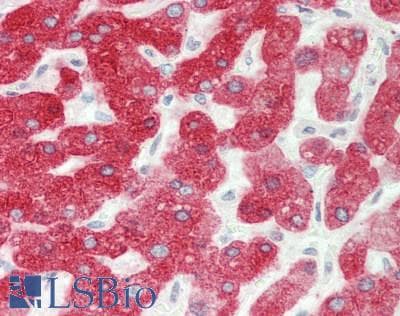 IHC-plus™ CYP2E1 Antibody (aa352-401)