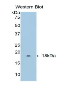 MB / Myoglobin Antibody (aa1-154, APC)