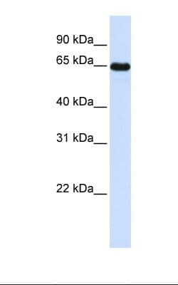 LMOD1 Antibody (N-Terminus)