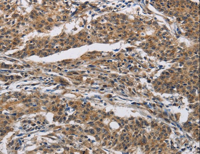 IFNGR2 Antibody