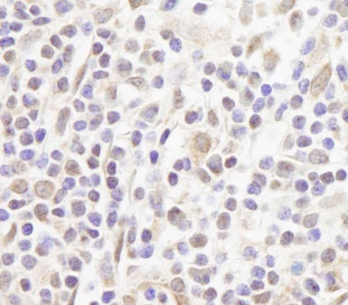 Polyclonal Rabbit anti-Human ZFPM1 / FOG1 Antibody (aa175-225, IHC)