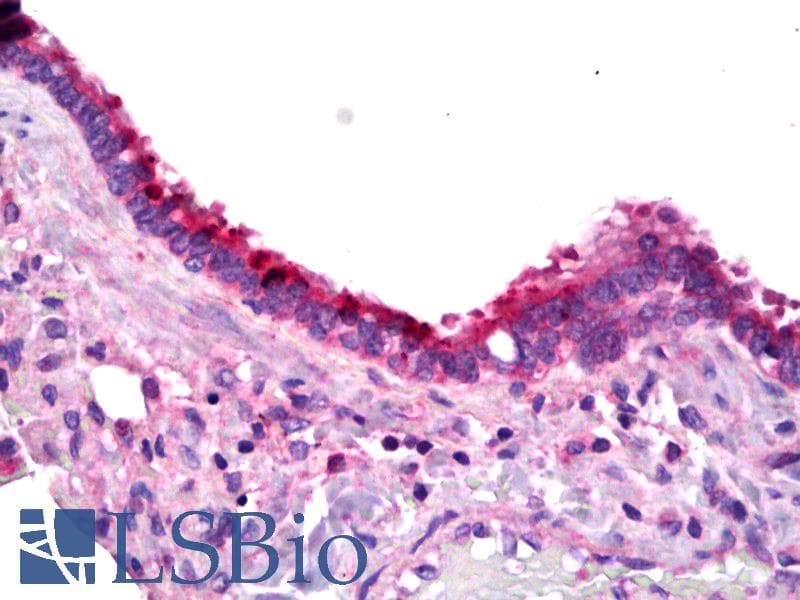 IHC-plus™ Polyclonal Rabbit anti-Human PTGER1 / EP1 Antibody (IHC, WB)