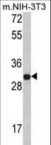 SLIM / FHL1 Antibody (aa214-240)