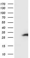 SSX1 Antibody (clone OTI1B5)