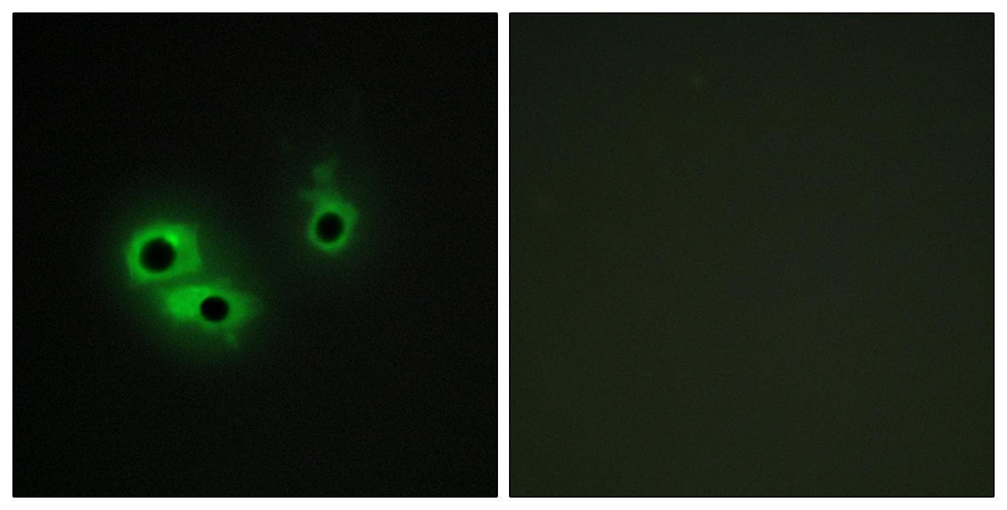 Polyclonal Rabbit anti-Human AG3 / AGR3 Antibody (IHC, IF)