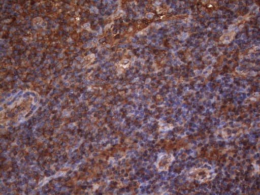 Monoclonal Mouse anti-Human MAP3K8 / TPL2 Antibody (clone OTI2E3, aa277-461, IHC, WB)