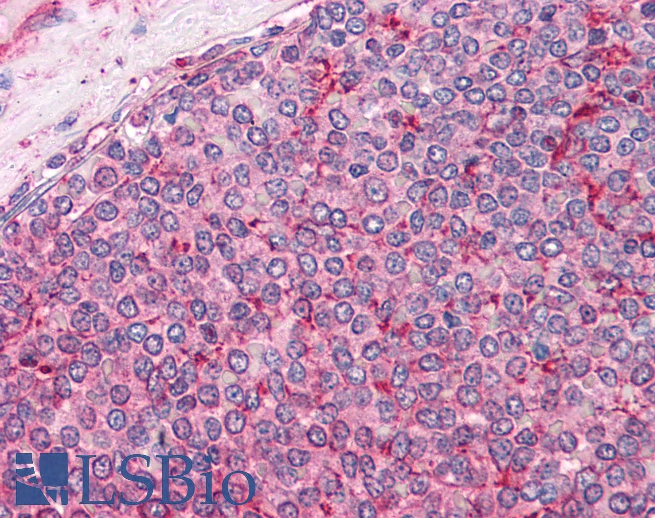 PathPlus™ CANX / Calnexin Antibody