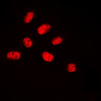 ELK3 / NET Antibody (phospho-Ser357)