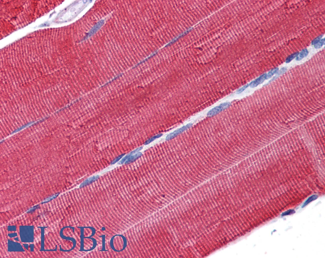 PathPlus™ Polyclonal Rabbit anti-Human ACTA1 / Skeletal Muscle Actin Antibody (IHC, WB)