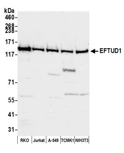 Polyclonal Rabbit anti-Human EFTUD1 Antibody (aa700-750, WB)