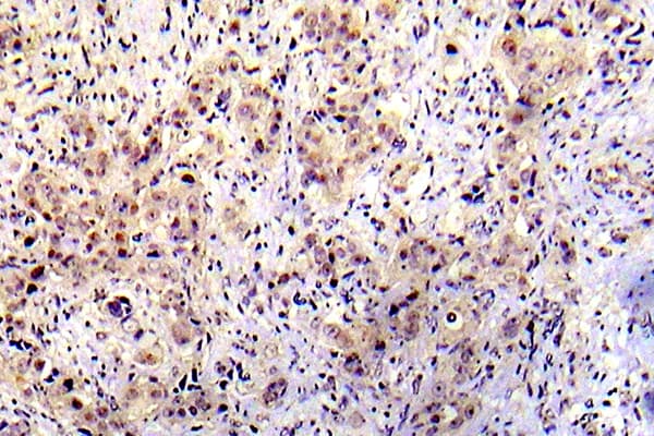 TP53 / p53 Antibody (phospho-Ser20)