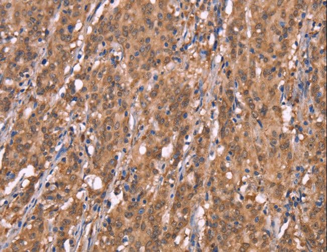 FBXO31 Antibody