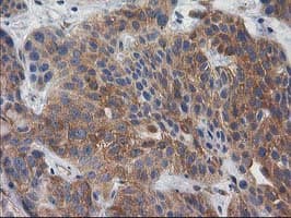 BCAR1 / p130Cas Antibody (clone OTI1A9)