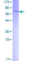Human FEN1 Protein (Recombinant GST)