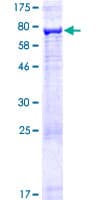 Human ARRDC1 Protein (Recombinant GST)