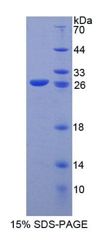 Human KEL / CD238 Protein (Recombinant His-T7)