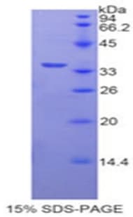 Human CPB2 / TAFI Protein (Recombinant His)