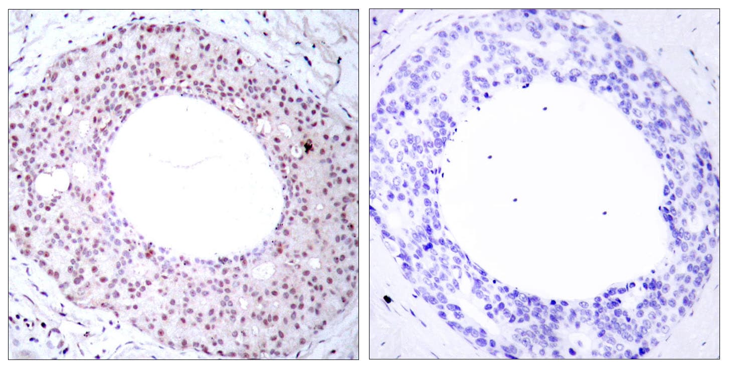 Polyclonal Rabbit anti-Human RELA / NFKB p65 Antibody (phospho-Thr254, IHC, WB)