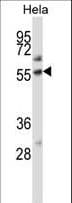 PLAP / Alkaline Phosphatase Antibody (aa282-309)