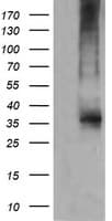 CD1C Antibody (clone 4C7, Carrier-free)