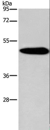 Polyclonal Rabbit anti-Human KCNG2 Antibody (IHC, WB)