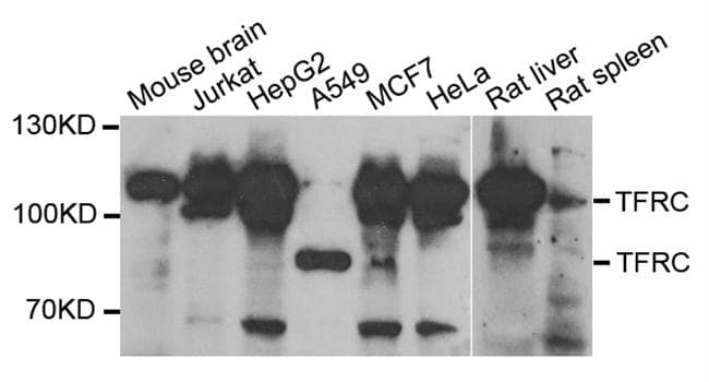 CD71 / Transferrin Receptor Antibody