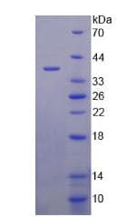 Human LPA / Lipoprotein a (Recombinant His, N-Terminal)