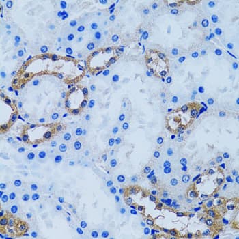 Polyclonal Rabbit anti-Human IMPA1 / IMP Antibody (IHC, IF, WB)